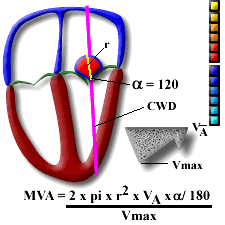 Aortic Valve Gradient